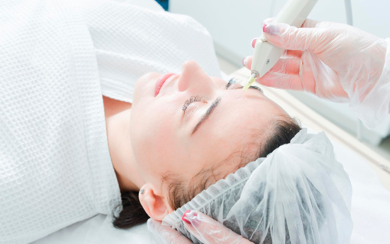 Carboxytherapy
