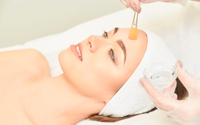Medical Grade Chemical Peel